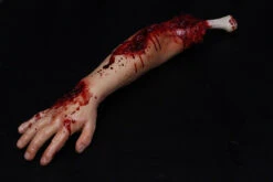 Exposed Bone Colin Arm