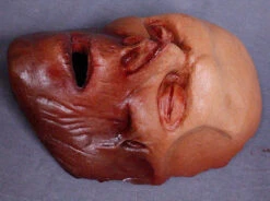 Dura Sallow Peeled Face Skin