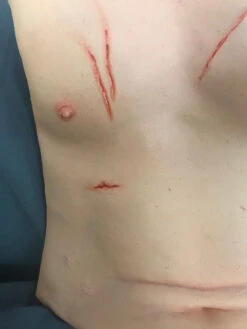 Trauma Torso Skin -Halloween Props Store 60a069 baf8fbeb1b6a4ae9af15f52ee5ae3391mv2