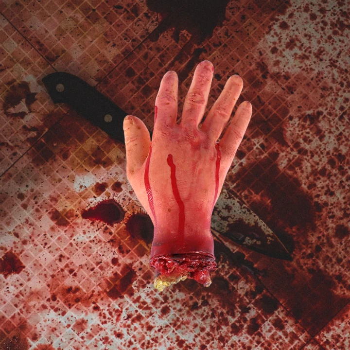 Severed Latex Hand With Bone Exposed