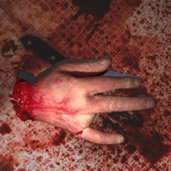 Severed Hand/ W Missing Finger